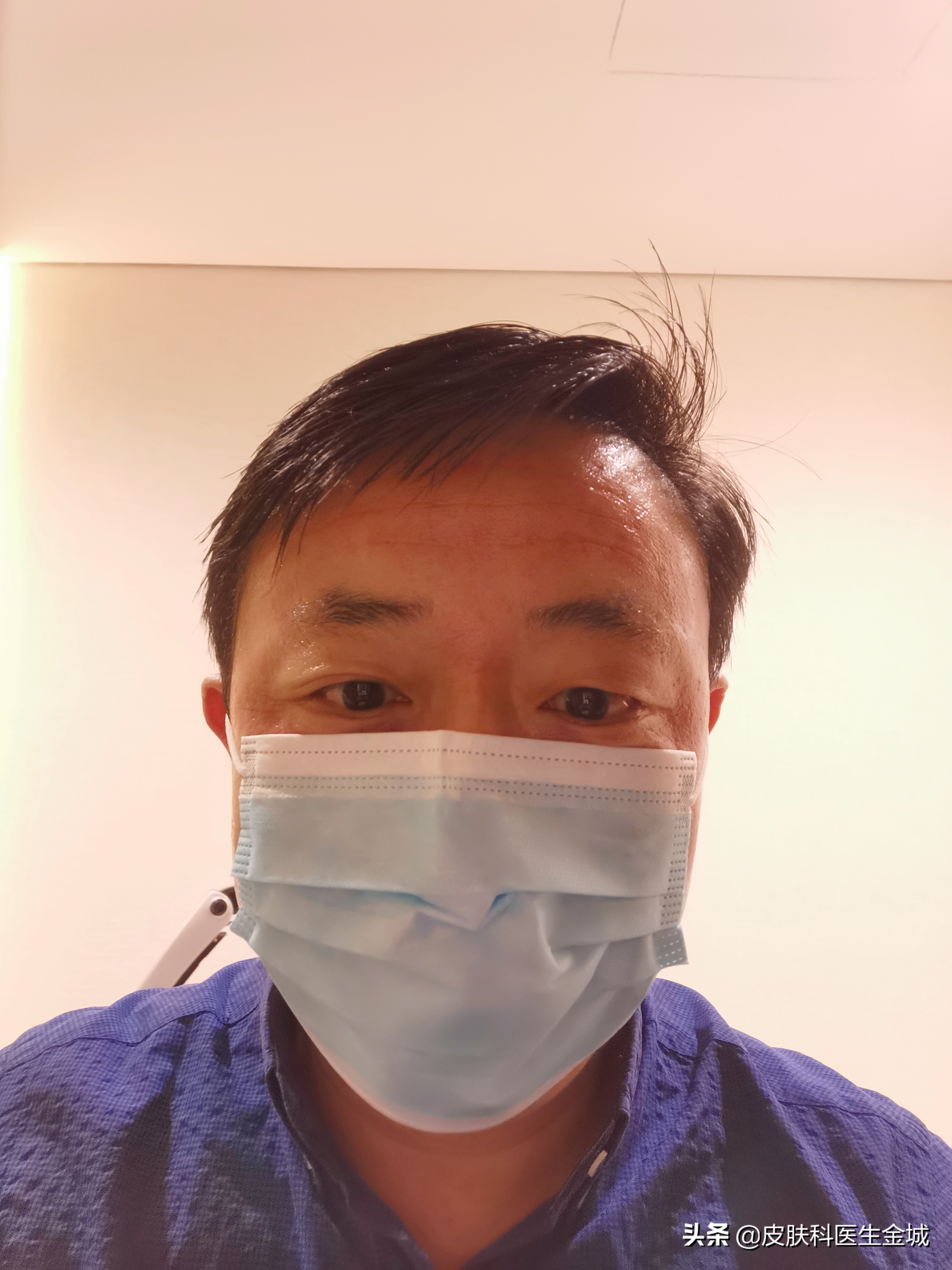 皮肤美容医生超皮秒全体验,皮肤美容医生超皮秒