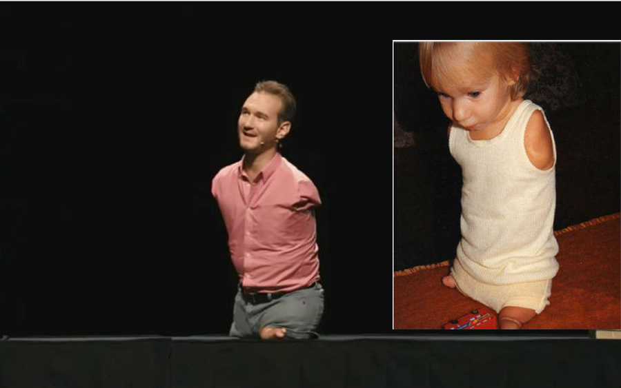 香港儿童重疾险理赔款,先天性疾病保险公司有赔偿吗