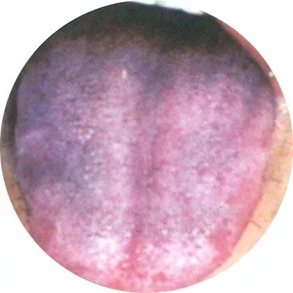 望舌知病实操完整版,教你看舌辨病