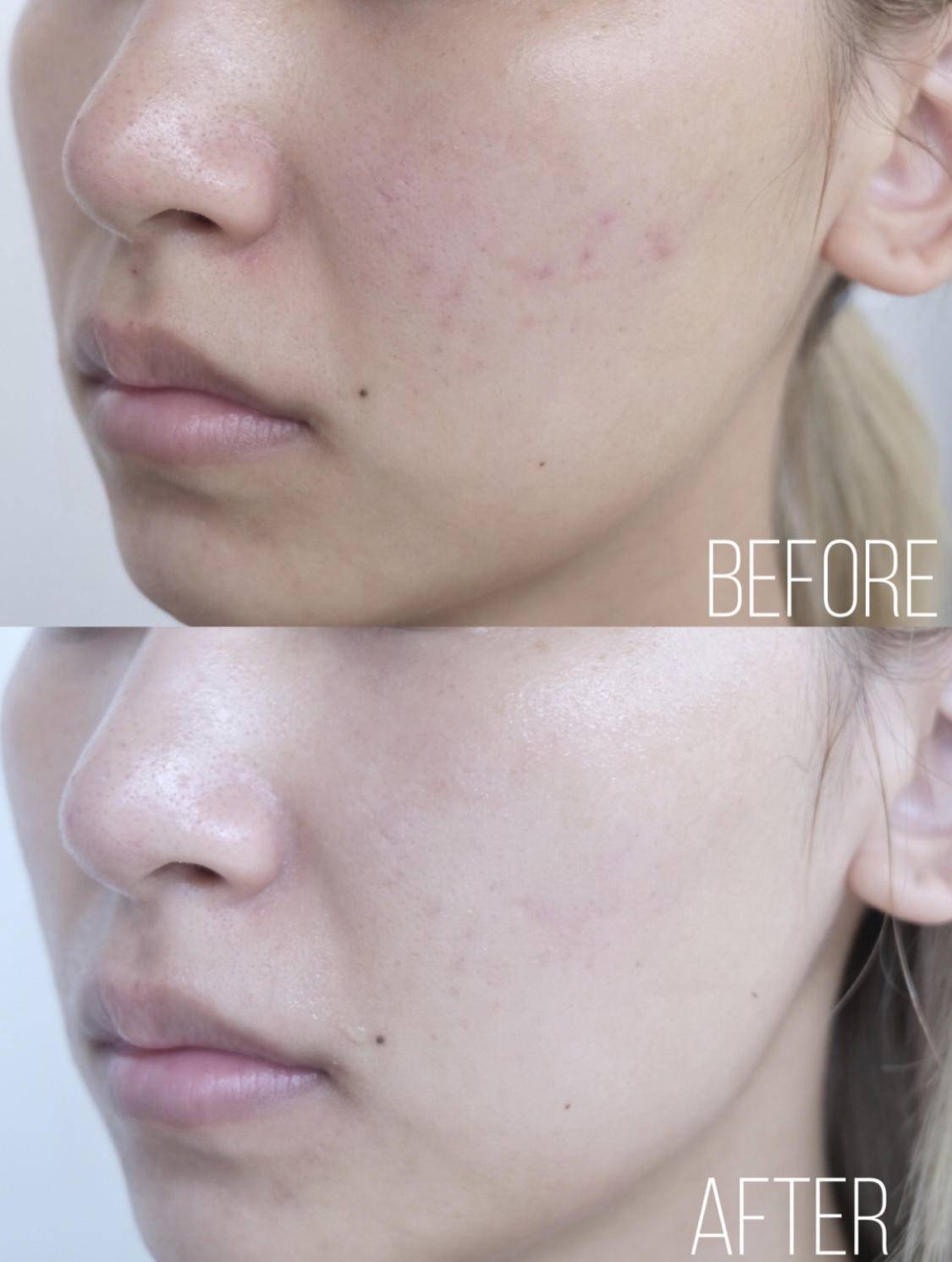 濂崇敓鐖嗙棙蹇呬拱娓呭崟鑽啅,鐖嗙棙浜у搧蹇呬拱娓呭崟