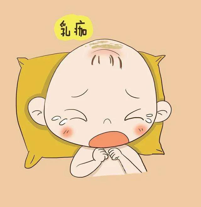 婴儿头上的污垢可以用香油吗,为什么婴儿头上长污垢