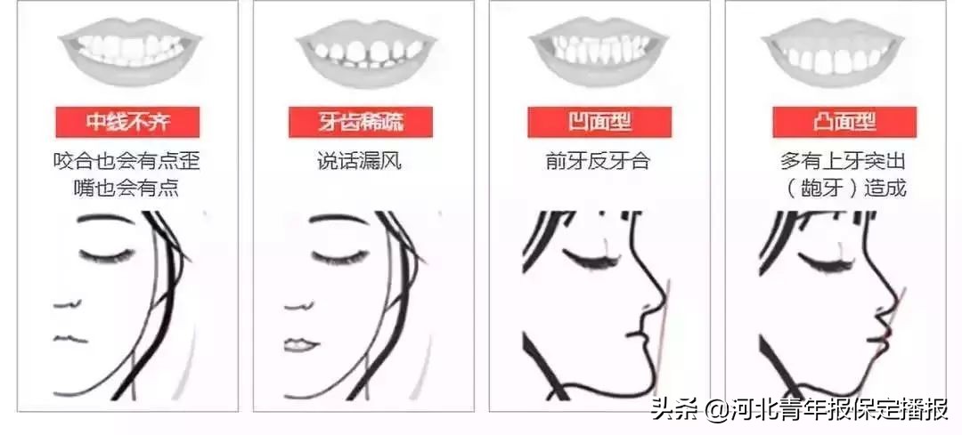 广大口腔公益种牙补贴,领取口腔优惠