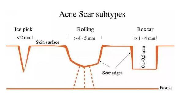 都挺好评分高还是低,都挺好后期