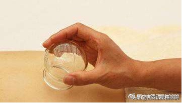 拔火罐的知识,拔火罐专业知识