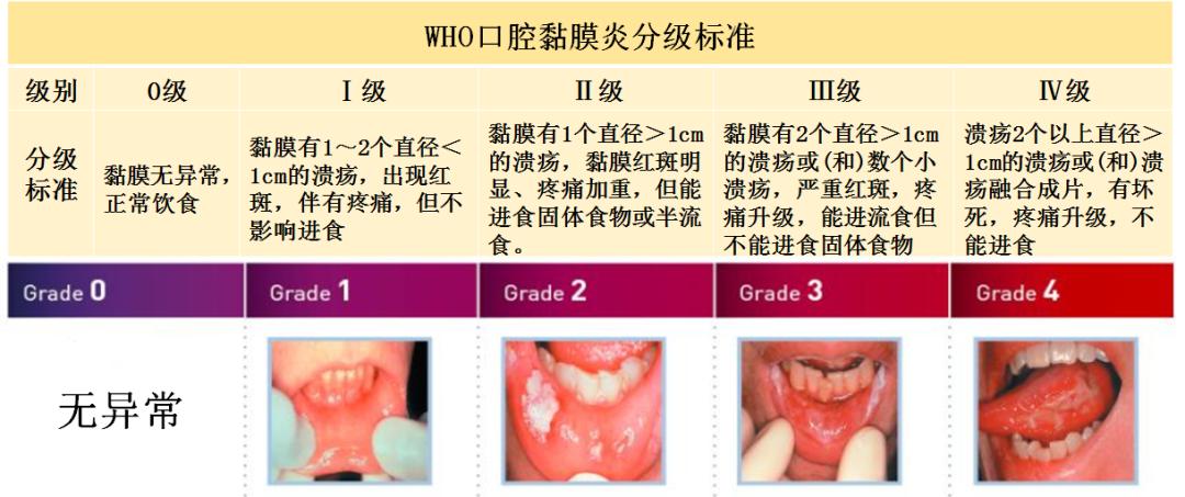 口腔溃疡如何快速缓解疼痛,口腔溃疡怎么缓解疼痛小技巧