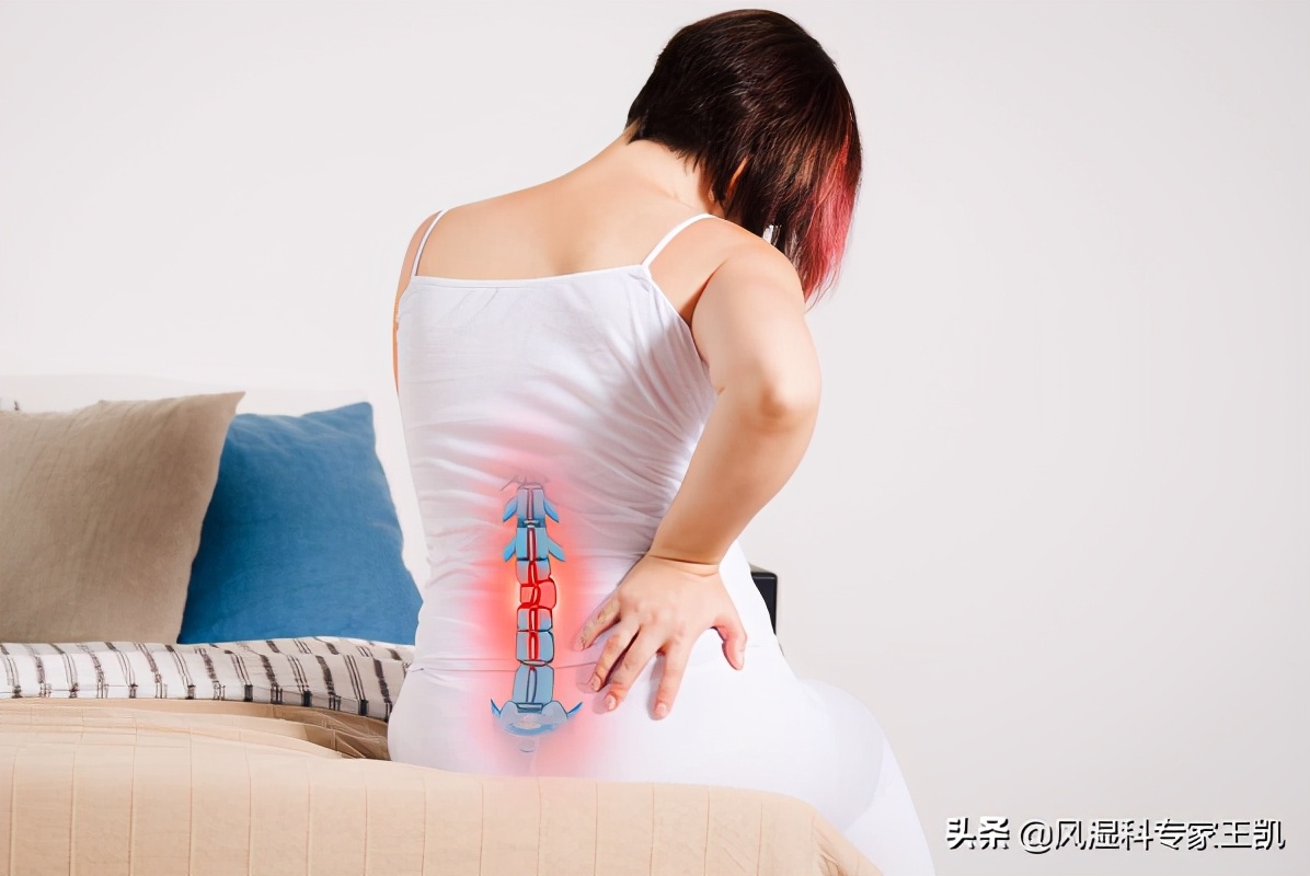 不死癌症脊柱炎,强直性脊柱炎又称不死的癌症