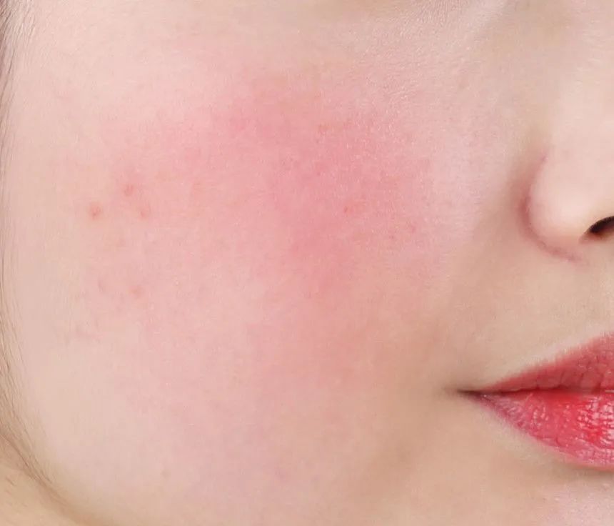 超补水超好用的芦荟胶,如果补水保湿只用芦荟胶可以吗