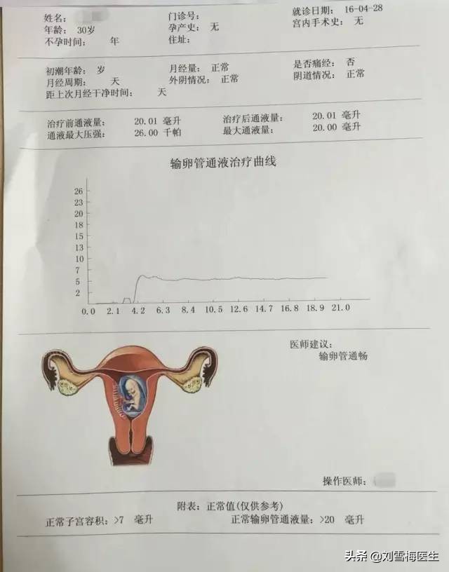 阴超检查可以查出输卵管吗,阴超可以查出输卵管有问题吗