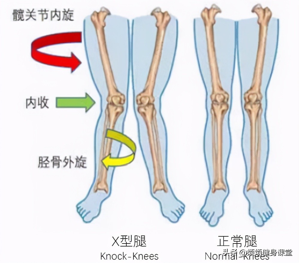 跑步膝盖内扣几个动作解决,膝盖内扣训练方法大全集