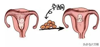 【孕期科普】一次讲清：HCG、孕酮和流产的“三角关系”