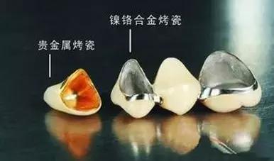 牙医怎么选科最好,牙医用什么材料补牙