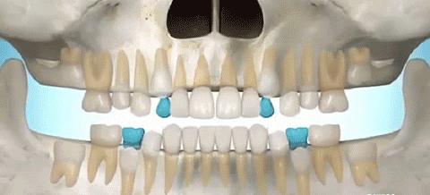 牙齿公益广告,2021年缺失牙公益援助行动