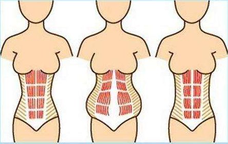 孕妇怎么避免腹直肌分离,孕妇腹直肌分离自测