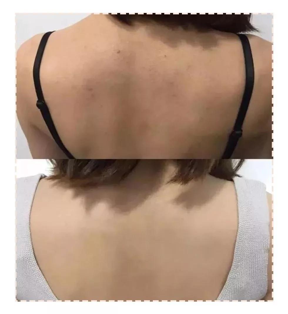 不打美白针还有哪些美白项目,快速美白内调不用美白丸