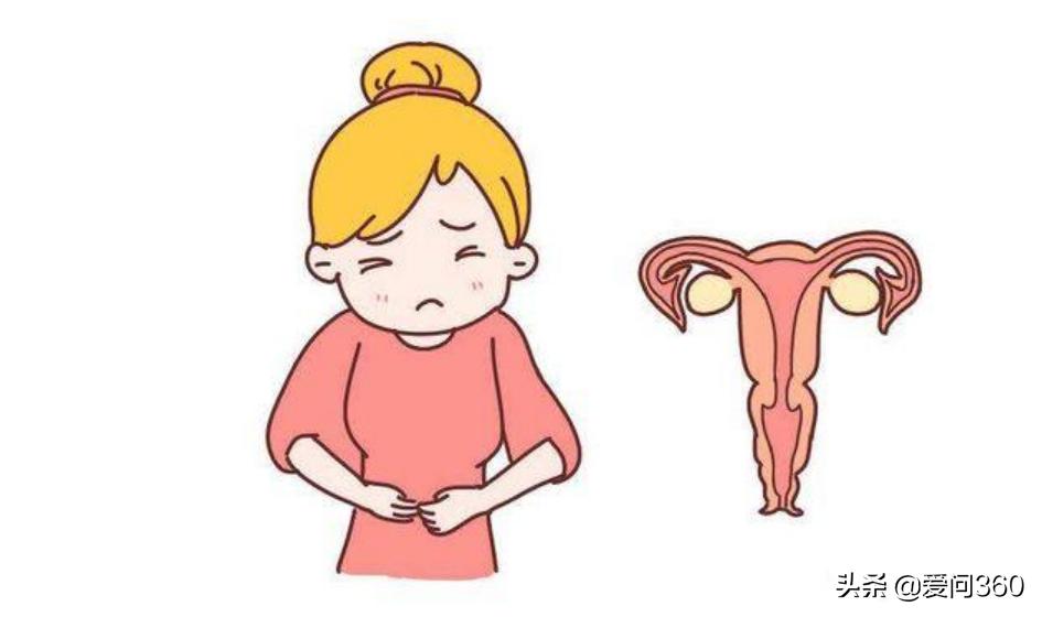 妇科炎症要注意哪些呢,妇科炎症需要注意哪些事项