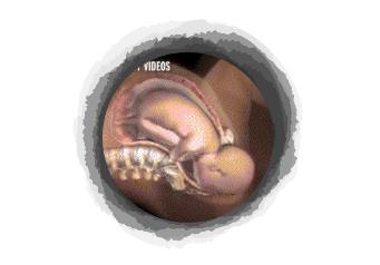 剖腹产宝宝自己从肚子里爬出来？分娩的时候宝宝和你一起在努力