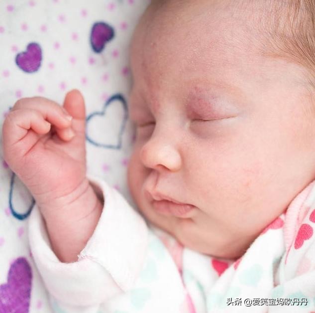 眼屎糊住眼睛睁不开小孩,宝宝眼屎多眼睛睁不开怎么擦掉