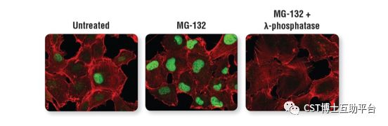 免疫荧光技术的优缺点,免疫荧光一抗二抗稀释比例