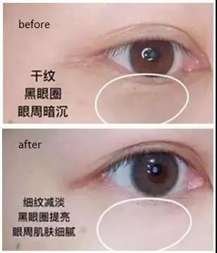 雅诗兰黛日本产的眼霜,用了雅诗兰黛皱纹更明显了