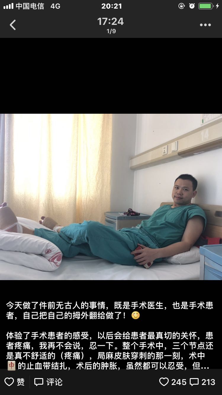 拇外翻微创手术的全过程,医生自己给自己做拇外翻手术