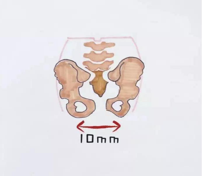 产后康复是怎么做的,中医康复和产后康复哪个最好