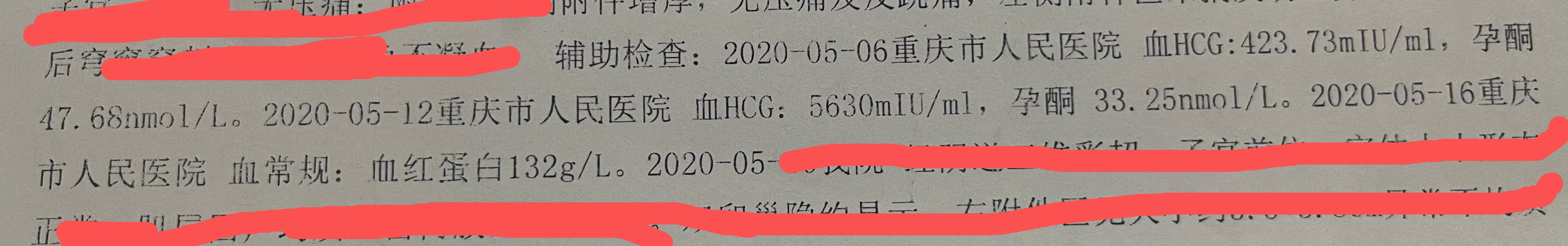 两次宫外孕是运气差吗,两次宫外孕左右各一边