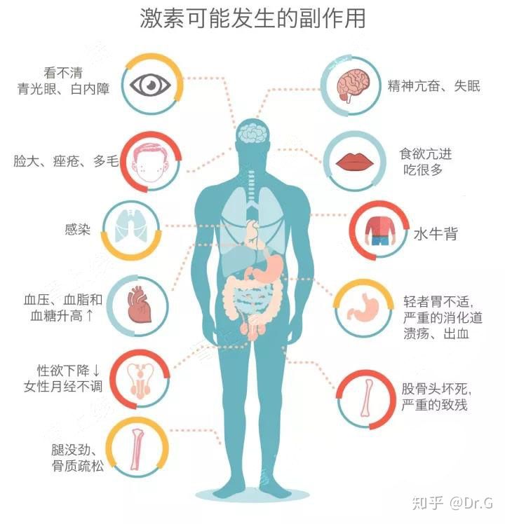 短时间用激素一定会股骨头坏死吗,没服过激素会股骨头坏死吗