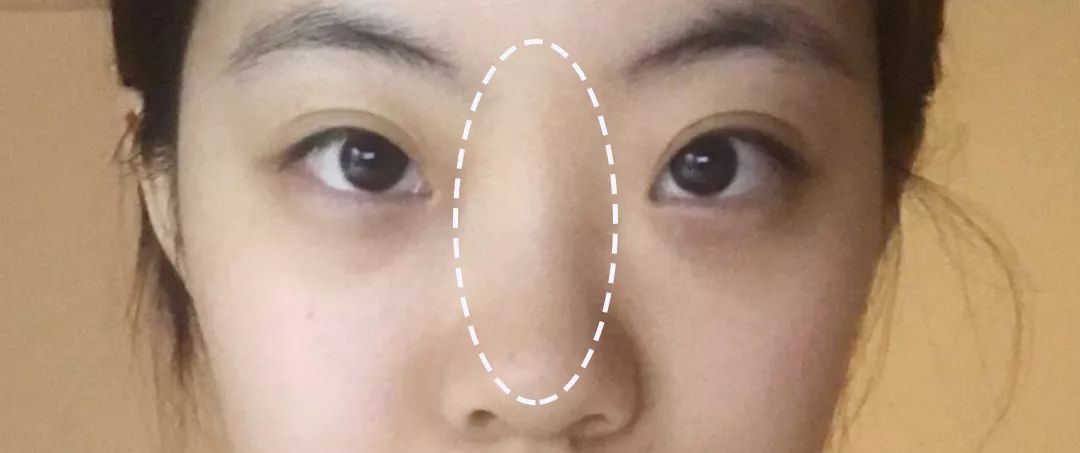 求改善痘痘真实办法,想改变脸上痘痘