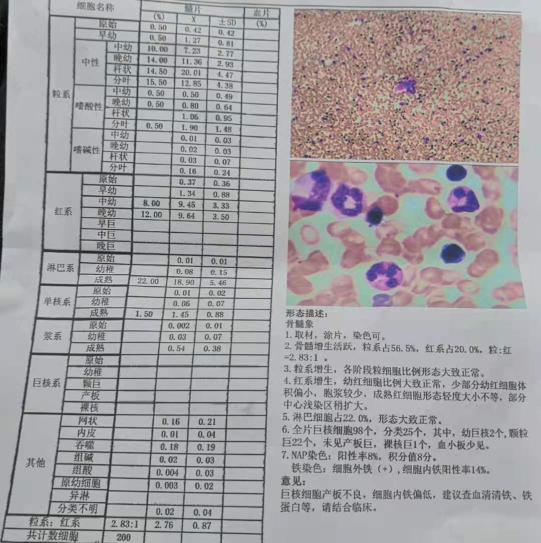 是谁揭开了血小板减少的面纱?