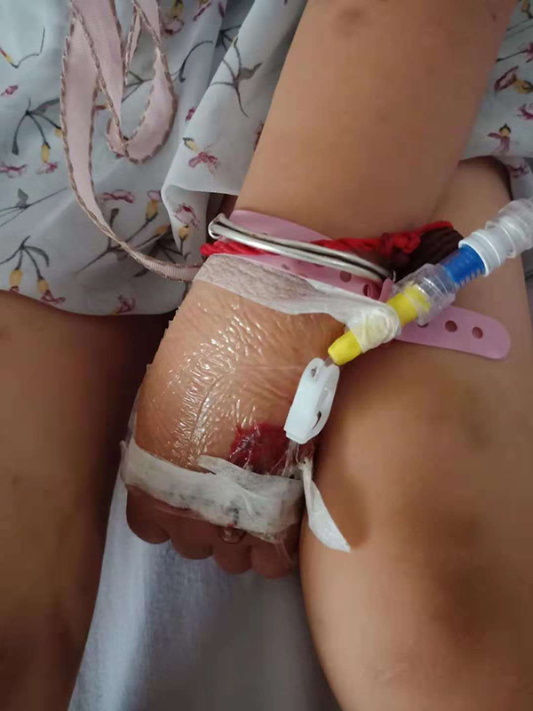 寄居“中途宿舍”：守着儿童血液科的家长们