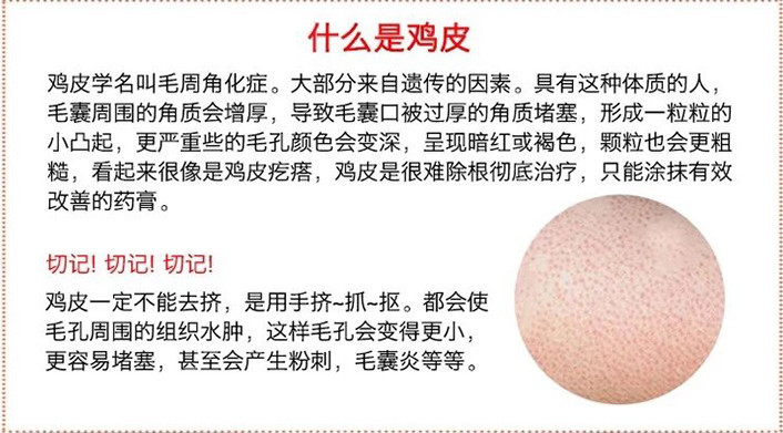 小孩脸颊两侧有小疙瘩像鸡皮,脸颊两边长鸡皮疙瘩