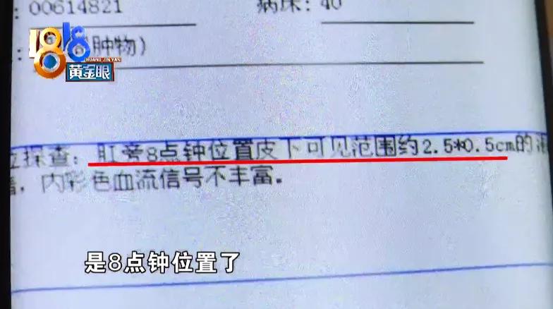 肛瘘纱布是扯出来的还是拉出来的,肛瘘手术后一直疼