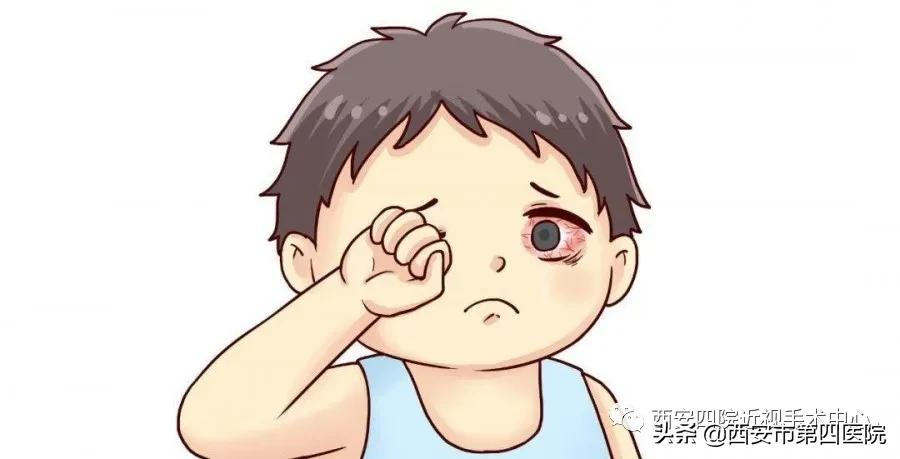 #我的健康十八式#【“睛”彩世界】最近总觉得眼睛痒，怎么办？