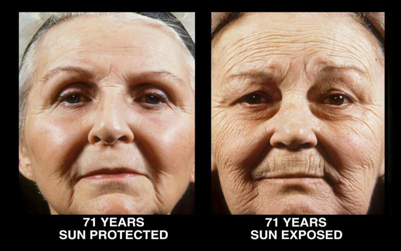 “表情纹杀手”来了，不磨皮轻松帮你hold住