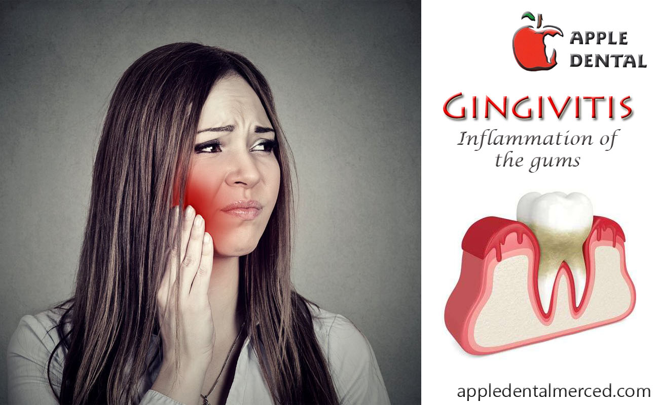 可怕的牙齿治疗,可怕的牙齿蛀牙