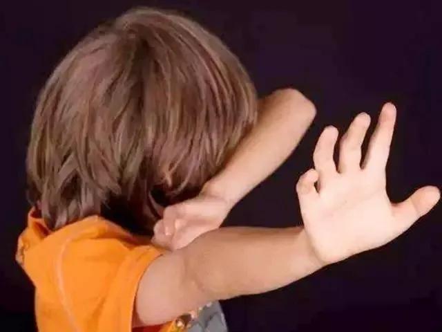 尿道下裂小朋友怎么护理,尿道下裂家长都怎么做的