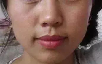 洗脸清洗黑头,洗脸清洁去粉刺