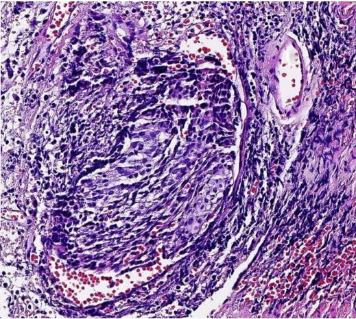 显微镜下的万花世界——走进病理学