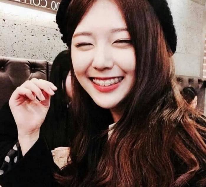 带牙套究竟是什么样的体验？过来人道出大实话，网友：心疼