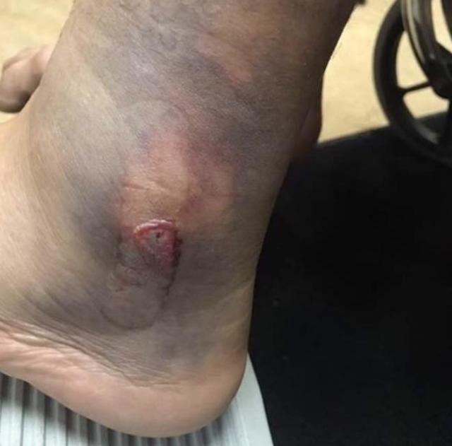 各种栓动步枪射击集锦,历史上射程最远的栓动步枪是哪个