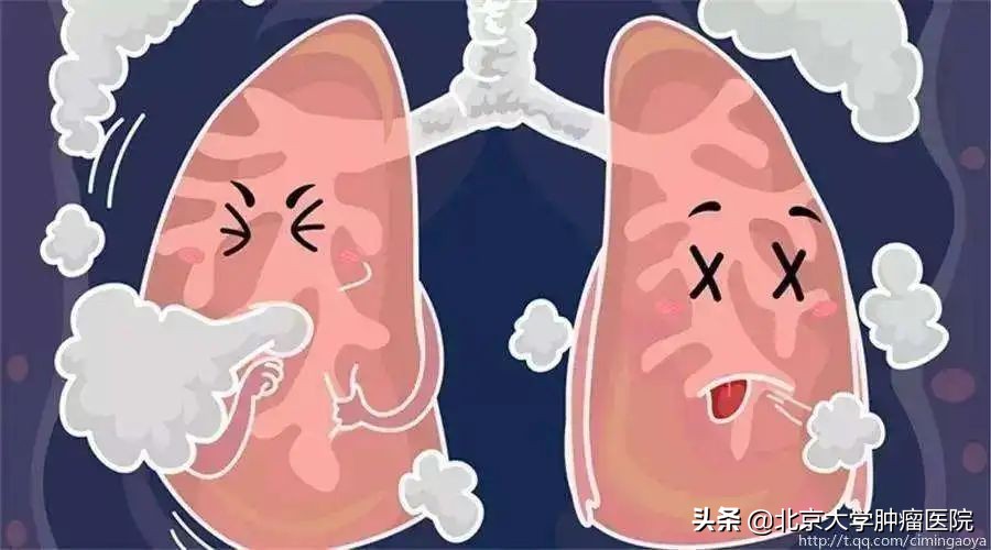 夫妻一方患了肺癌会传染吗,肺癌患者的口水会不会传染肺癌