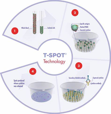 怀疑肺结核一定要查三次痰吗,医生怀疑是肺结核的几率有多大