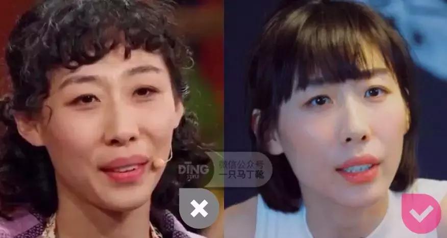 中庭又长又宽显老,中庭长怎么避免显老