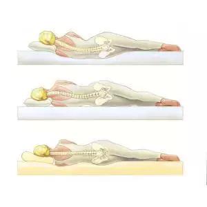 驼背怎么矫正扩胸,矫正胸型防驼背