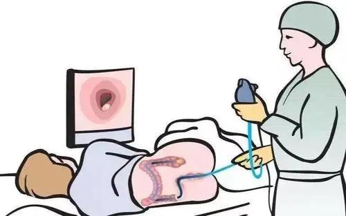 便血不止，大娘当“痔疮”越治越严重！肠镜王子“内镜绝技”巧除肠内巨大肿瘤