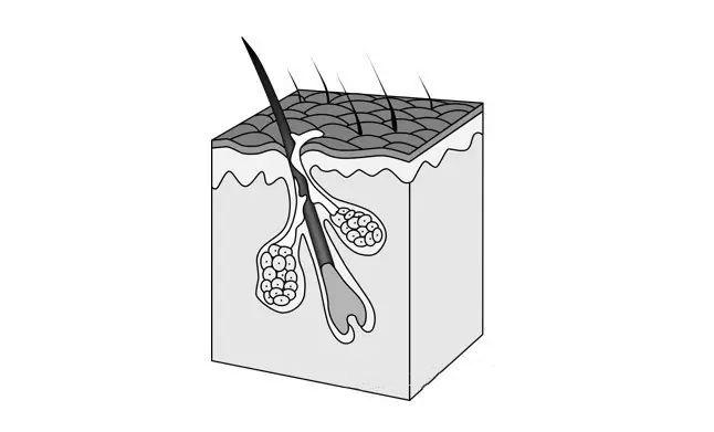 皮肤出油厉害怎么科学用药控油,皮肤出油怎样保湿