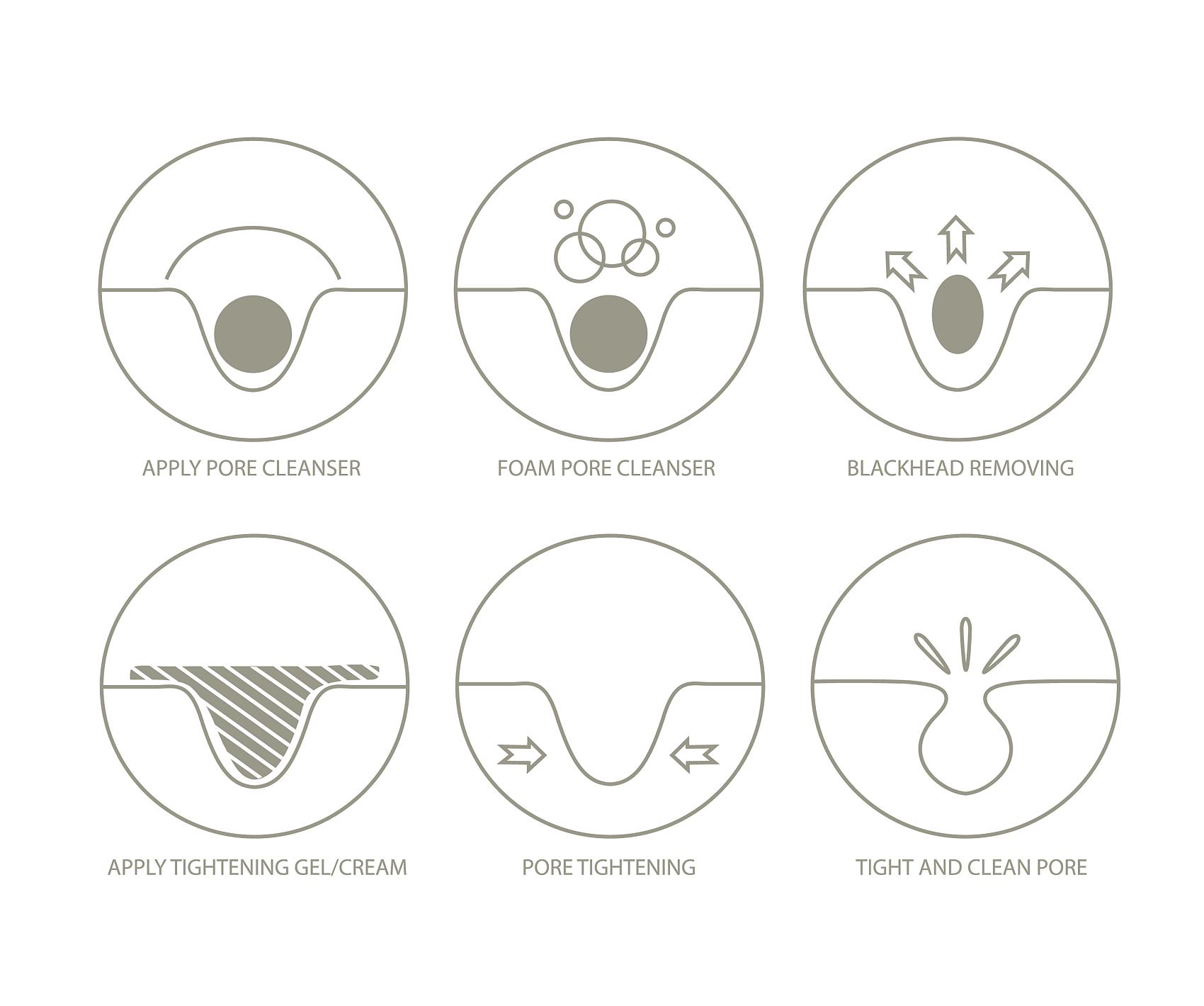 消灭痘痘闭口的方法有哪些,消灭闭口重现光滑肌soeasy