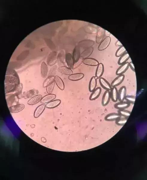 四岁女宝宝说小便地方痒用什么药,四岁女宝宝说小便地方痒怎么治疗