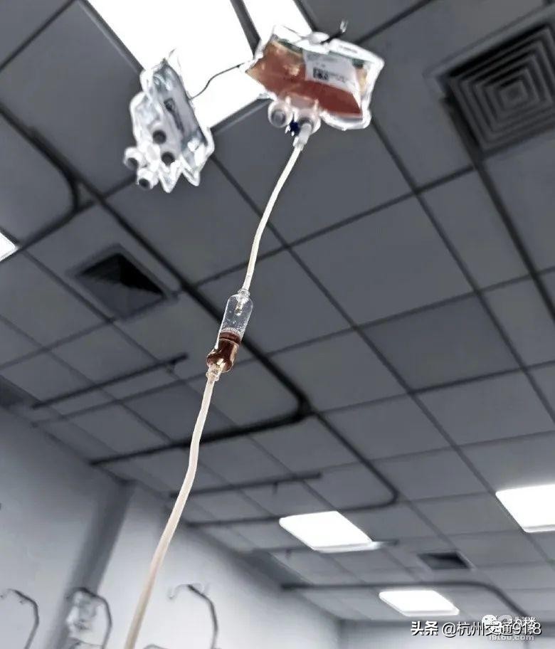 90后姑娘熬夜10年长出老年斑,杭州姑娘熬夜