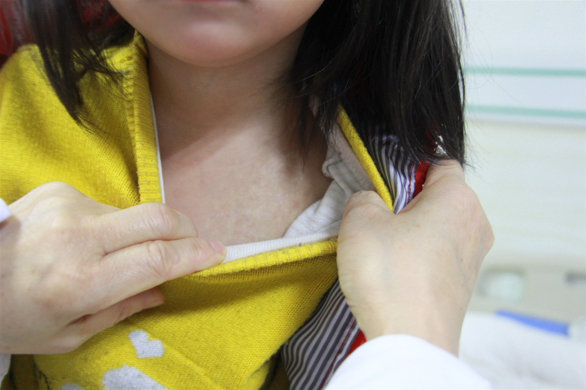 乳房血管瘤用什么方法治最好,乳房上有樱桃状血管瘤怎么治